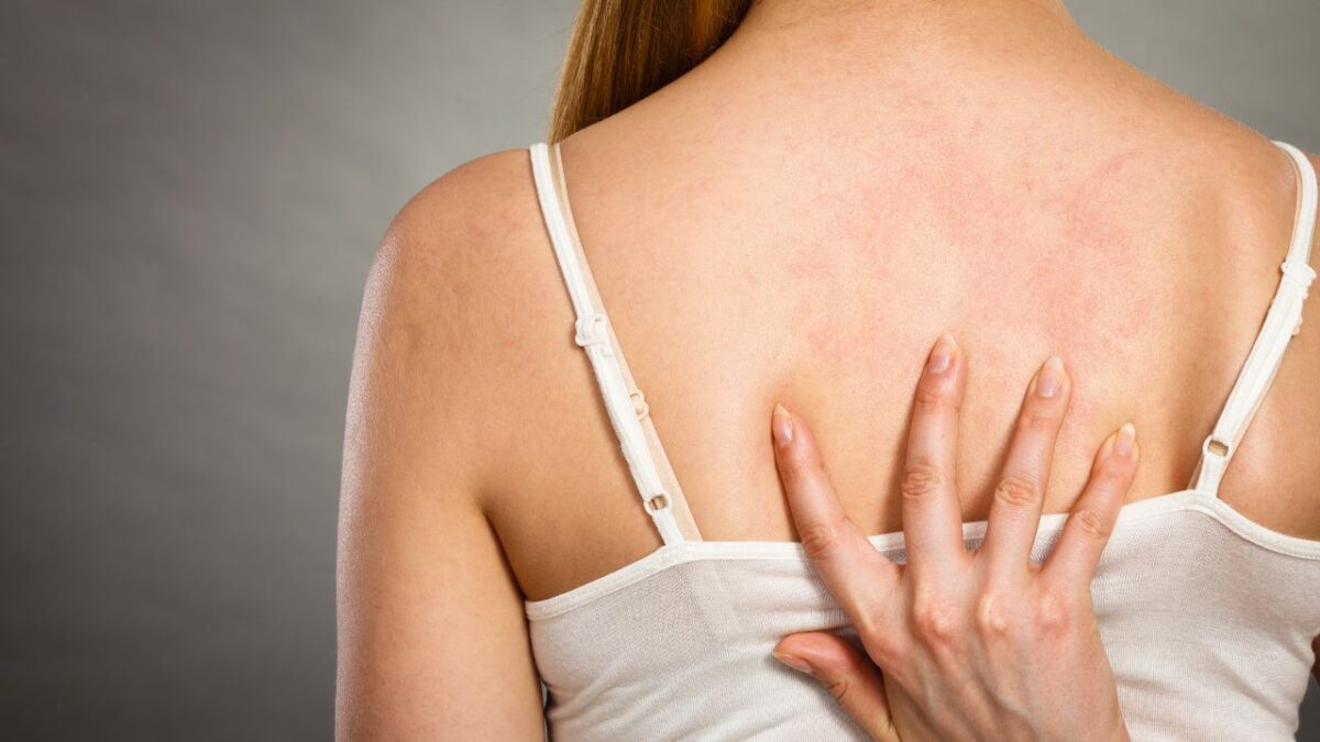 woman scratching her itchy back