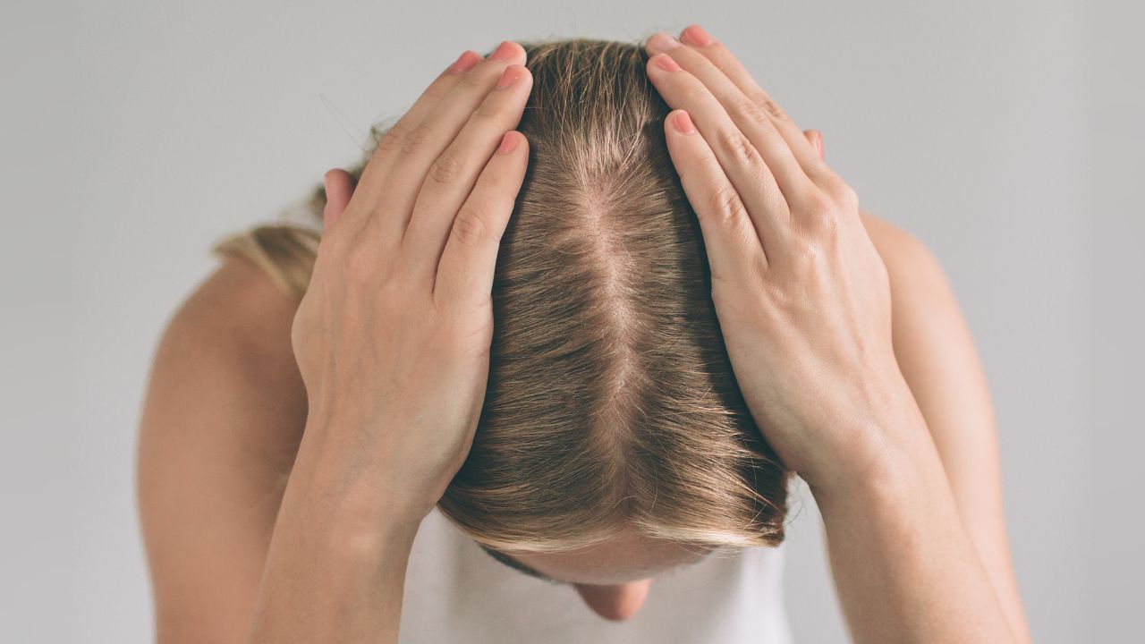 women hair loss